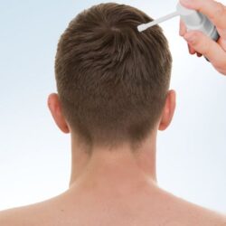 minoxidil-nedir,-ne-ise-yarar?