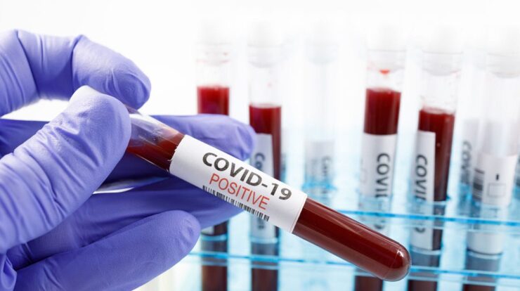 koronavirus-test-sonucu-kac-saatte,-gunde-cikar?-omicron-test-sonucunda-gorunuyor-mu?