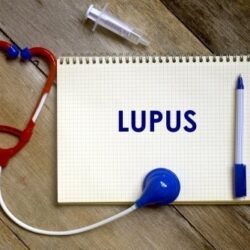 lupus-icin-risk-faktorleri-nelerdir?