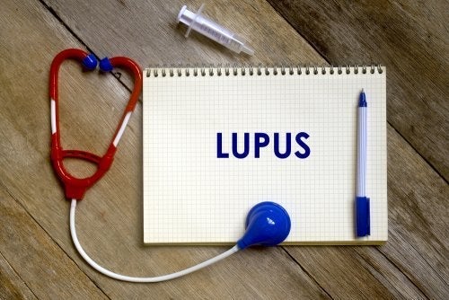 lupus-icin-risk-faktorleri-nelerdir?